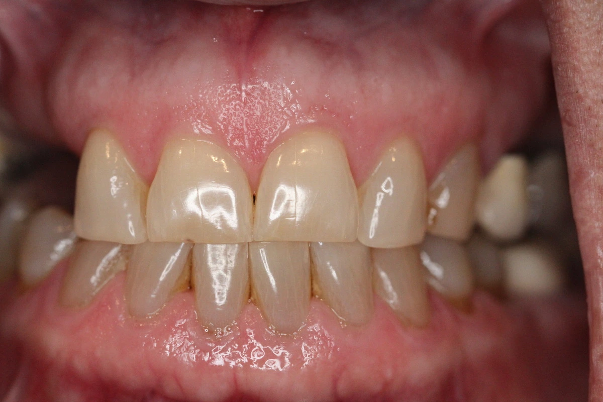 restoring health and confidence after